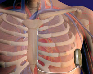 Cameron’s $107M Plan: FDA Trial, Manufacturing